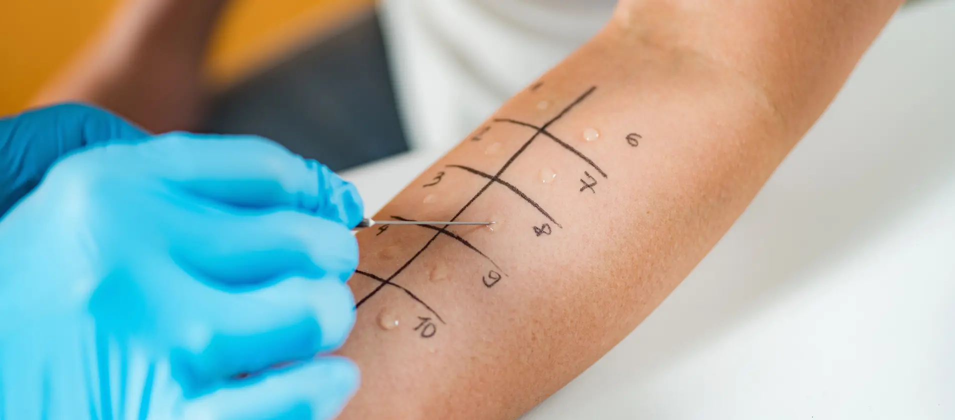 Allergy and Immunology Billing Services
