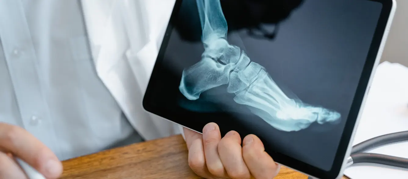 What-Is-Orthopedic-Coding
